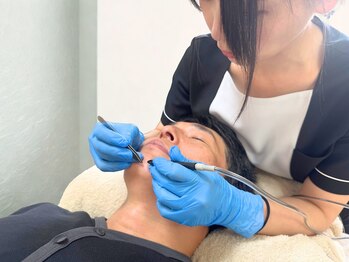 アディール(adire)/美容電気脱毛/メンズ脱毛/顔脱毛