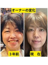 ヨサパーク ナンシー(YOSA PARK Nancy)/オーナー変化☆顔が違い過ぎ！