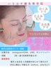 【6月限定２名様】美容鍼モニター