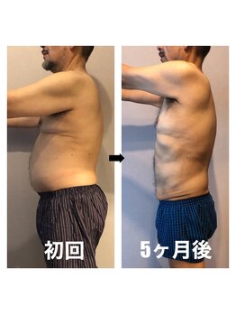 伊達男/フォースカッター　事例