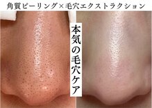 ミルフィオリ(Mille fiori)