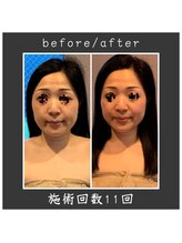 サロン ド ハーモニー美/コルギ♪小顔・面長改善等