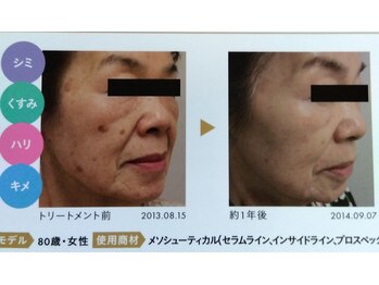 シエル/白玉スノーピール