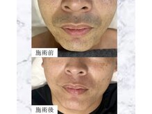 フォー(the 4)の雰囲気（最新マシンの脱毛効果に驚きの声多数◎）