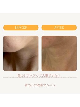 ムーンライズ(moonrise)/