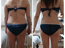 ミルグレイン(MILGRAIN)/1ヶ月半で