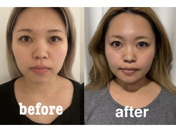 マホロバ(mahoroba)/一年後の変化