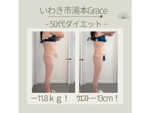 グレース(Grace luxe)