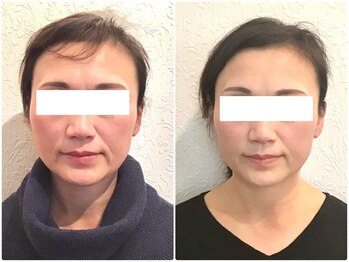 美容整体ウェリナ 中川八田院/小顔矯正/骨盤矯正/美脚サロン