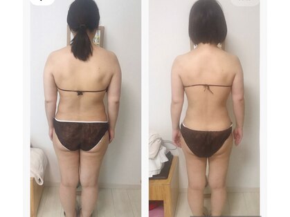 ビューティーチャージ(BeautyCharge)の写真