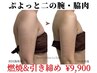 【二の腕・脇】 サイズダウン・引き締め｜ 燃焼マシン 60分¥23,200→¥9,900