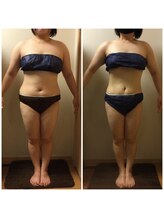 ロータス(Lotus)/30代　(左)ビフォー(右)アフター