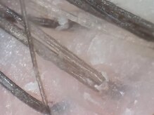 リッツ 渋谷店/ベタつき、ニオイ、かゆみの原因
