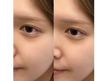フェルナ(FERNA)の雰囲気（完全オーダーメイドデザインをご提供♪）