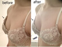 ブレスト 新宿本店(Breast)/《1回目》20代（バストアップ）
