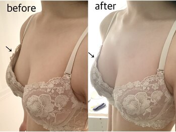 ブレスト 新宿本店(Breast)/《1回目》20代