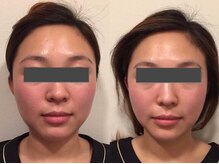 サロンリーナ 銀座店(SalonLena)/骨造★コルゾウ　商標登録