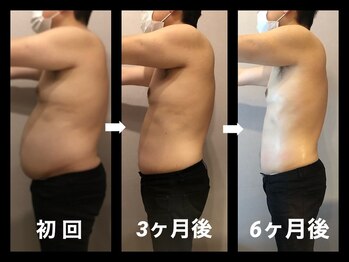 伊達男/フォースカッター 事例