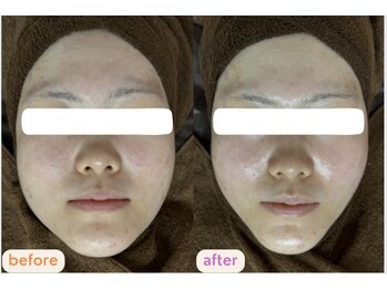 サクラ(SAKURA)/浮腫みやすい方に◎