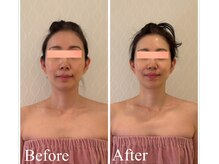 カイロD.C.認定ゴットハンドプロデュース韓国発祥の小顔美顔術