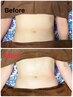 【Sora限定】お試し　女性のみ腸活＆くびれメイクコース60分