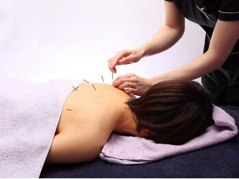 シー バイ カリスタ 新宿南口店(C by CALISTA)/うつ伏せ鍼で肩こりをすっきり