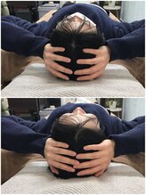 カルペード 中百舌鳥/なかもず院(Carpe D.)/施術後の変化