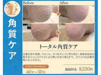 巻き爪補正店 枚方店/トータル角質ケア