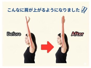 のなか整体院/整体 Before→After