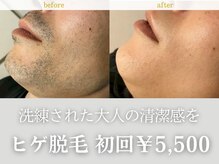 ディサイドロー(DECIDE L.A.W)の雰囲気（どんな肌悩みも改善したい方におすすめです♪）