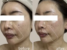 ブルーム(BLOOM)の雰囲気（クリニックしかないと諦めてる方はWISHproをお試しください！）