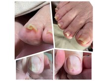 マムズネイルプラス(mam’s nail plus)の雰囲気(爪切りから巻爪等のトラブルネイルにも対応。お悩み相談受付中。)