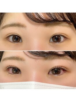 ラプティット(La petite)/NOBIRU 伸び~るラッシュリフト