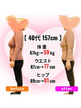 さらさ整骨院/ダイエット整体ビフォーアフター