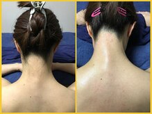 クラウン ジュエルズ(CROWN JEWELS)/【Wax脱毛】うなじ　正面 6