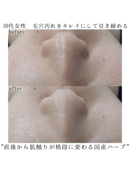 ヴェルシック(Belchic)/毛穴汚れも目立たなく