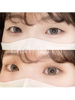 キュア(CURE)/瞼スッキリ!