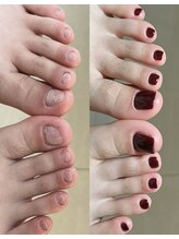 めぐみのネイルサロン/フットネイル