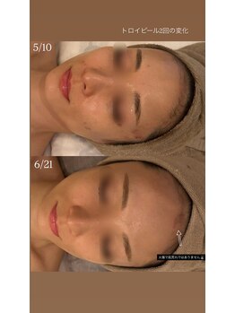 セレニテ(Serenite)/