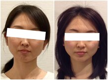 美容整体 ウェリナ 蟹江院/小顔矯正/骨盤矯正/美脚サロン 