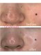 レアビューティー(Le'a beauty)の写真/お肌を綺麗にしたい方必見！《医療機関と提携するサロン》一人一人に合った施術をお悩み別にご提案します◎