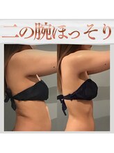 ボディエステティック アクアオーラ 富山店