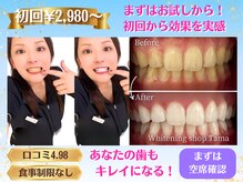 ホワイトニングショップ 多摩店