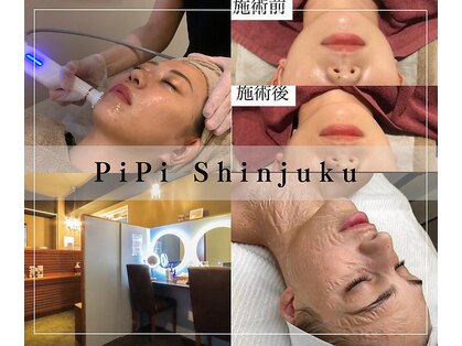 ピピ(PiPi Shinjyuku)の写真