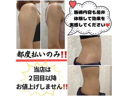 ディオーネ(Dione)の写真