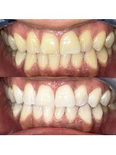 ライトビューティー 池袋店(LightBeauty)/症例写真