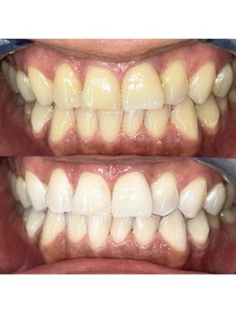 ライトビューティー 池袋店(LightBeauty)/症例写真