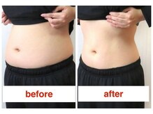 にこ。/姿勢整体×痩身エステ