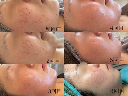 ルヴェル(Revel)の写真