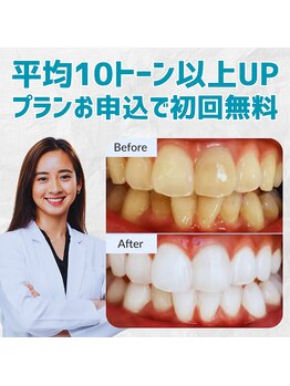 スマイルホワイト 赤羽店の写真/歯科提携ジェル使用・月額通い放題プランで、コスパも効果も抜群のホワイトニングサロン◎